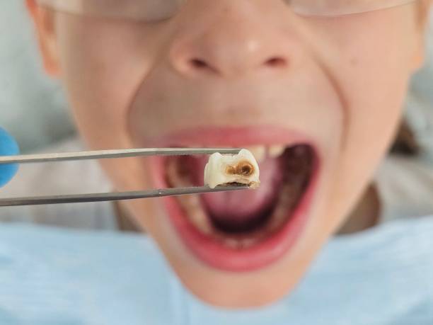 Professional Emergency Dental Service in WV